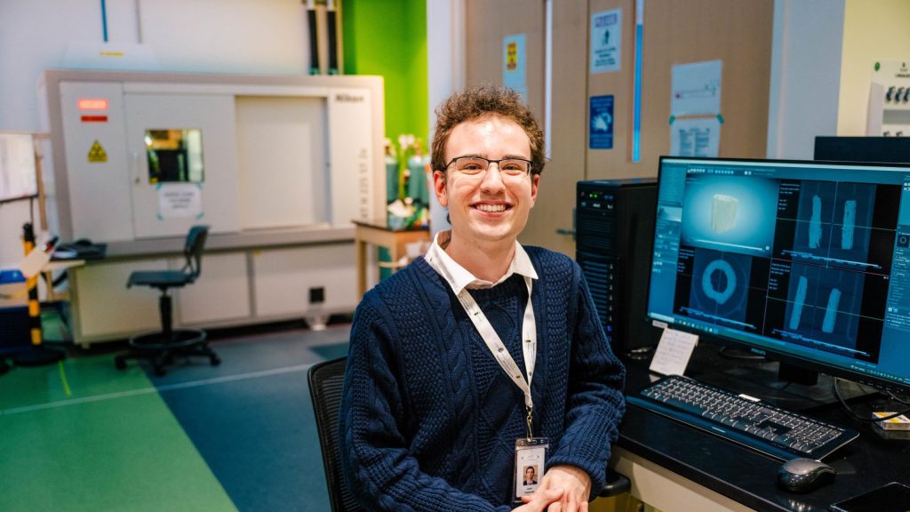 A senior majoring in biology with a minor in chemistry, Jonah Tatsapaugh has spent the last three semesters developing an innovative method to analyze the microstructural growth of thigh bones of individuals aged 3 months to 18 years.